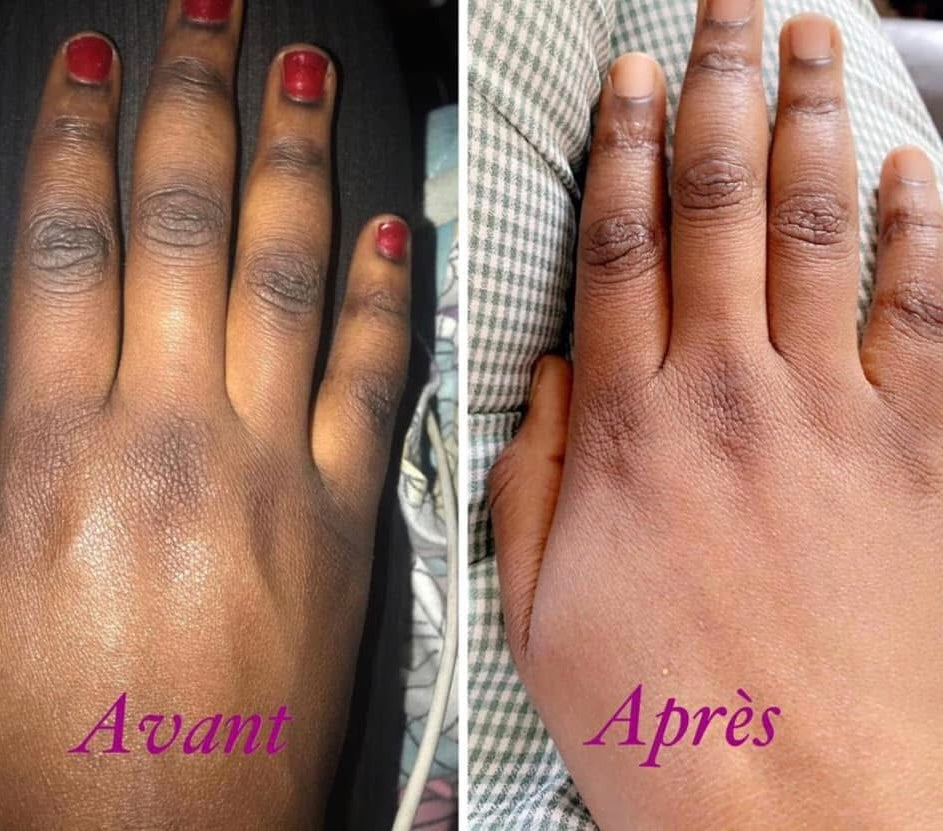 Correcteur de Zones Sombres