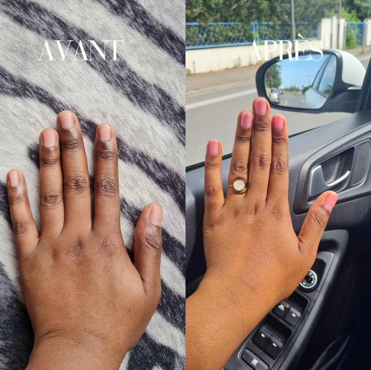 Correcteur de Zones Sombres