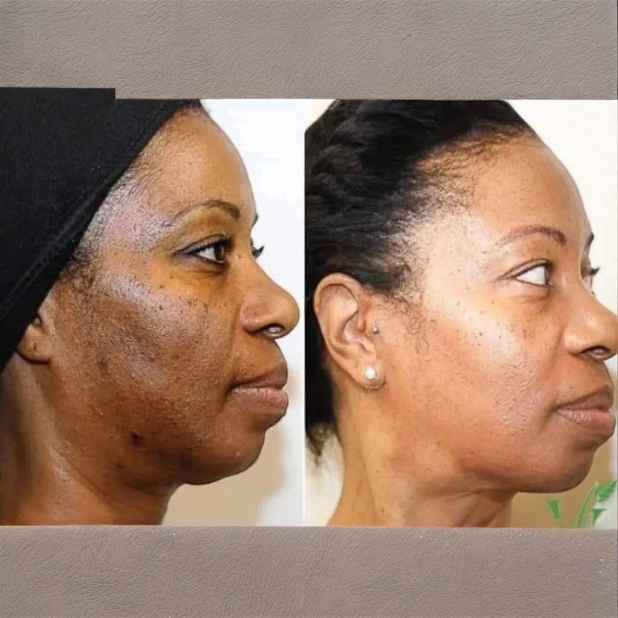 Crème Visage Anti-Imperfections
