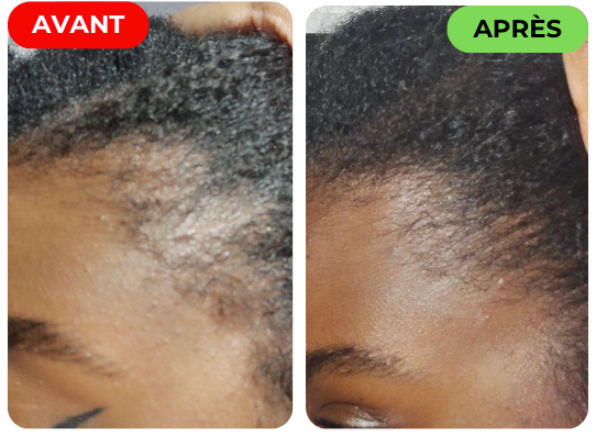 Hair Royal Oil